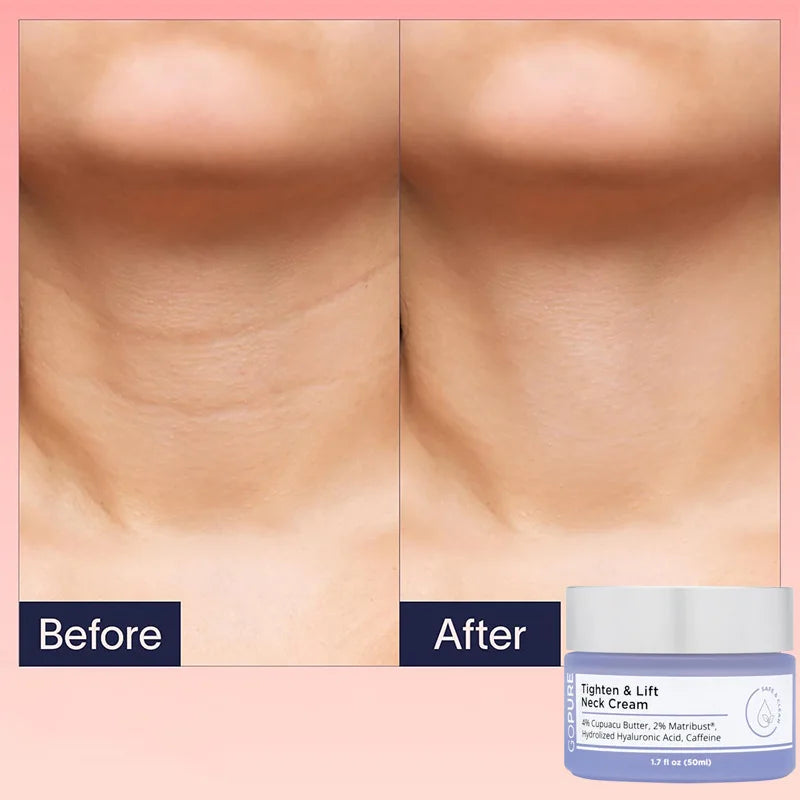 GoPure Tighten & Lift Neck Cream ✨💖 Firms, Lifts & Hydrates | Vegan & Cruelty-Free